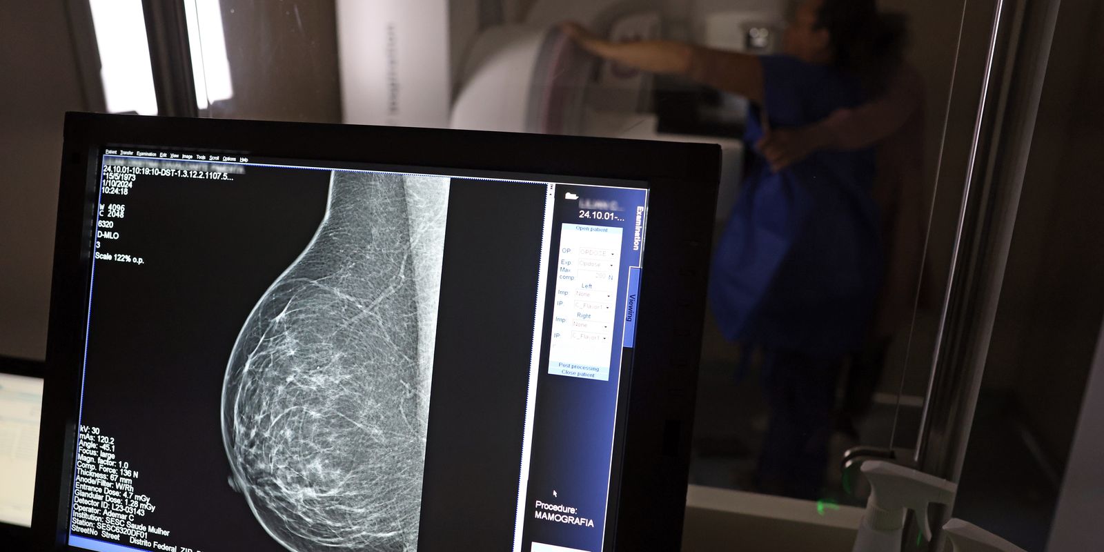 Guia médico orienta como evitar a recusa de mamografia digital por planos