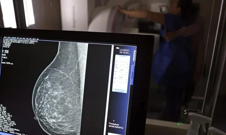 Guia médico orienta como evitar a recusa de mamografia digital por planos